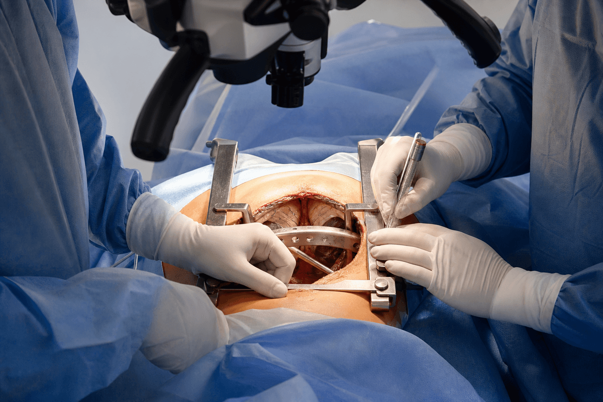 Pectus Excavatum Reconstruction